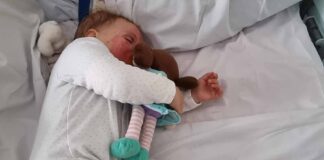Half marathon in aid of Great North Air Ambulance Charlotte suffered burns across her face and body
